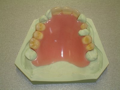 traagheid Montgomery Verdorie Dental Care Lichtaart - Prothese (gebitjes)